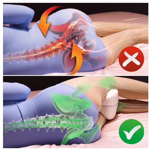 Dreamolino ortopéd térd- és lábtámasztó párna alvás közben